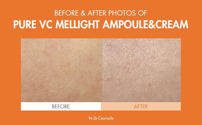 Dr.Ceuracle by leegeehaam Pure VC Mellight Ampoule - Vitamin C Serum for Face, One Week Program for Anti-oxidant, Firm, Clarify, Fade Pigmentation, Skin Radiance (4 Counts (Pack of 1))