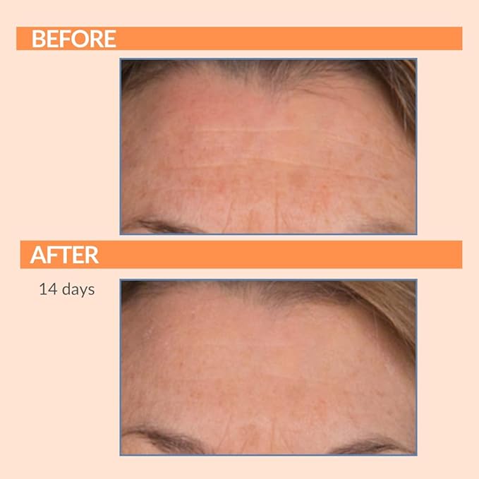 Serious Skincare - Vitamin C Day & Night Skin Care Set - Brightening Face Serum, Daytime SPF Moisturizer, Restore Night Cream, Face Wash - C3 C Esters for Hydrating, Fine Lines and Wrinkles (4Pack)