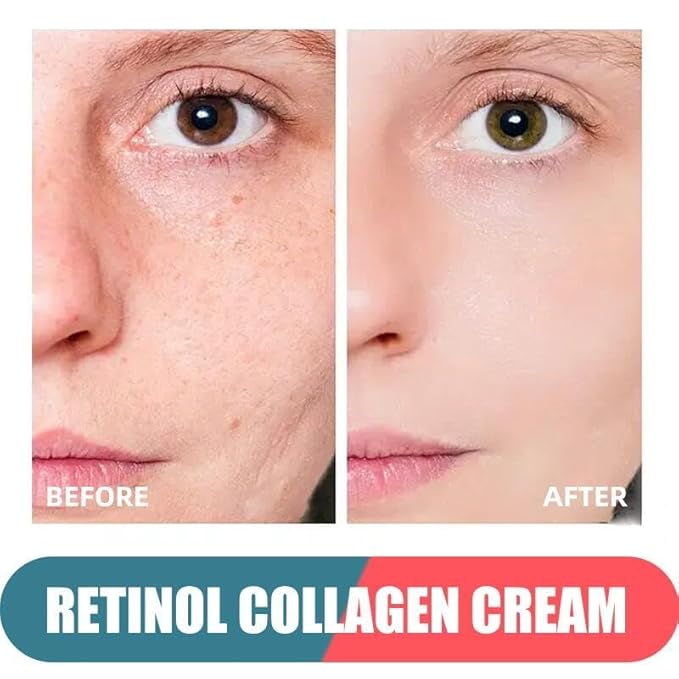 Retinol Cream for Face with Hyaluronic Acid, Day & Night Anti-Aging Moisturizer for Women and Men, Collagen Cream for Face Reduces Wrinkles, Dryness 1.7 FL Oz