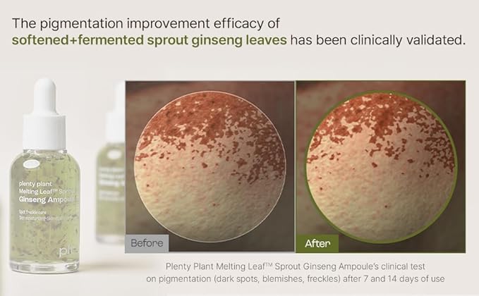 Plentyplant 65.7% Sprout Ginseng | Korean Serum with Melting Sprout Ginseng Leaf | Ginseng Extract Essence with Hyaluronic Acid, Peptides, Niacinamide | Face Serum for relief