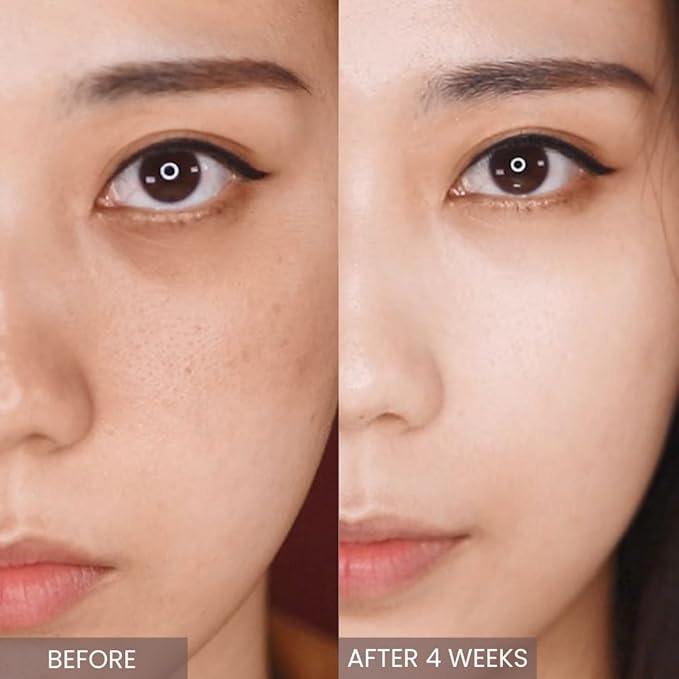 Retinol SERUM/Skin Moisturizer/Facial Moisturizers/APLIN Official/Korean Cosmetics/Korean Skin Care/Retinol