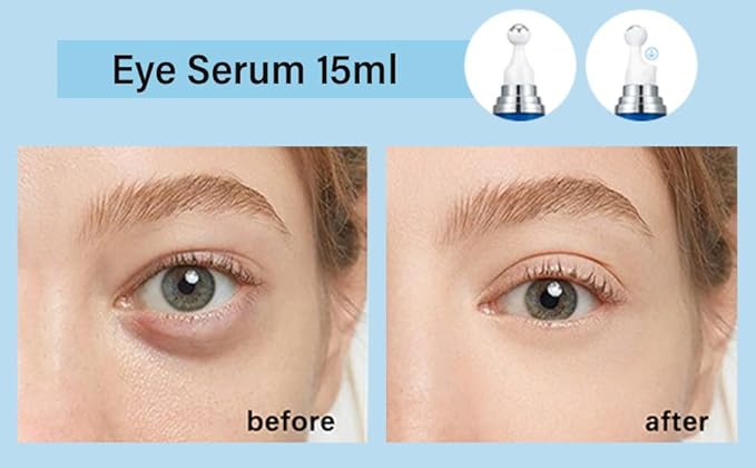 5% Caffeine Eye Serum, Anti-Aging Hydrating Eye Serum with 360° Massage Ball,Caffeine Eye Roller Reduce Wrinkles and Fine Lines,Under Eye Roller Cream for Dark Circles and Puffiness