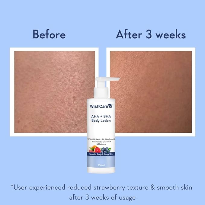 10% AHA + 1% BHA Body Lotion for Men & Women - Body lotion for dry skin - Detans, Smooths Rough & Bumpy Skin 200ml