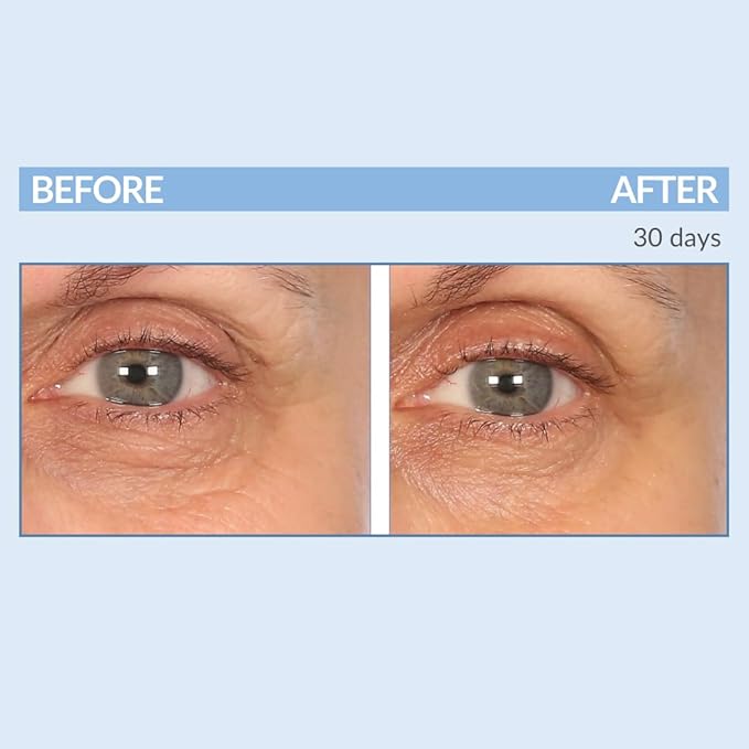 Serious Skincare - Eyetality PM Eye Night Cream with Resveratrol - Keratin & Lash Boosting Peptides for Thicker, Longer Lashes - Antioxidant-Rich to Treat Under Eye Signs of Aging 0.5 FL.Oz.