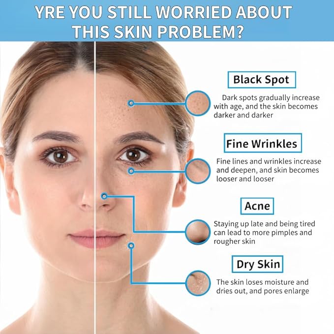 10% Niacinamide + 1% Zinc Face Serum, Nourishing & Refreshing Facial Serum ， Women Serum for Oil Control and Acne 30ML/1 Fl Oz