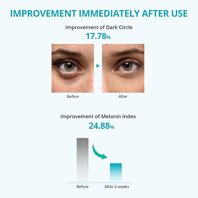 Re.SPN Bakuchiol Firming Roller Eye Cream, Niacinamide, Retinol, Adenosine, Caffeine | Self-Care, Vegan, Intense Hydration | Cream with Guasha, Glass Skin, Korean Skin Care(20ml/0.67 fl oz)