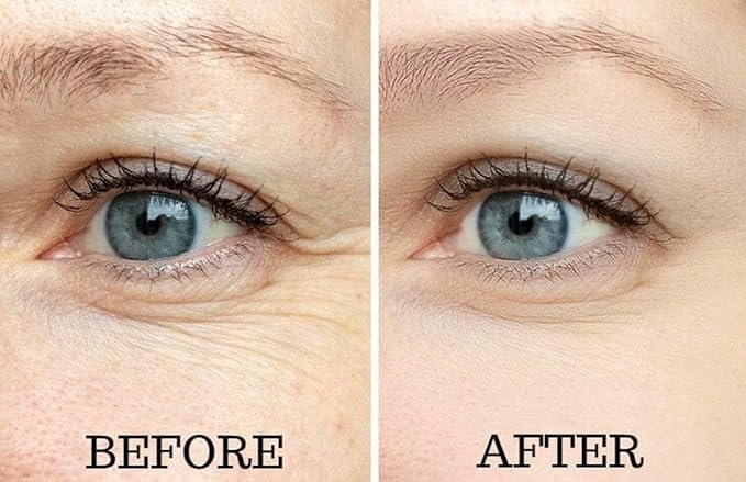 Osmotics Under Eye Rejuvenator, Anti Aging Eye Cream For Dark Circles, Eye Bags, Fine Lines, Puffiness. Best Anti Aging Eye Cream for Wrinkles, Crows feet, And Puffy Eyes