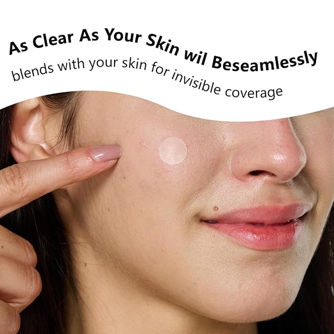 Pimple Patches for Face, Hydrocolloid Acne Patches, Absorb Zits and Blemishes, Invisible Spot Cover, Treatment for Breakouts, Acne Stickers with Salicylic Acid and Tea Tree Oil (24 Count)