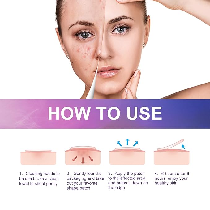 144 PCS Acne Patches Cute Pimple Patches for Face and Skin - Hydrocolloid Acne Treatment Dots to Cover and Reduce Zits, Blemishes, Spots, Star Pimple Patch