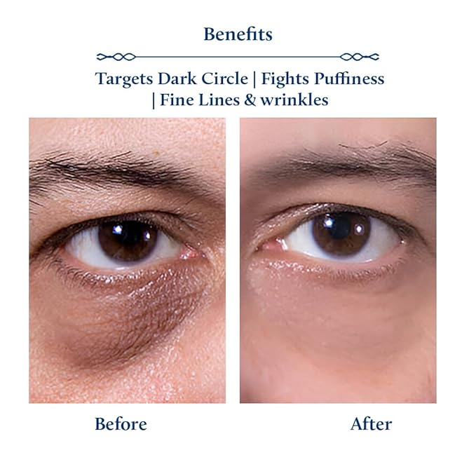 Blue Nectar Shubhr Under Eye Cream for Dark Circles with Papaya, Potato Starch & Niacinamide | Best Under Eye Cream for Men | Eye Cream for Dark Circles & Wrinkles (18 Herbs,15ml)