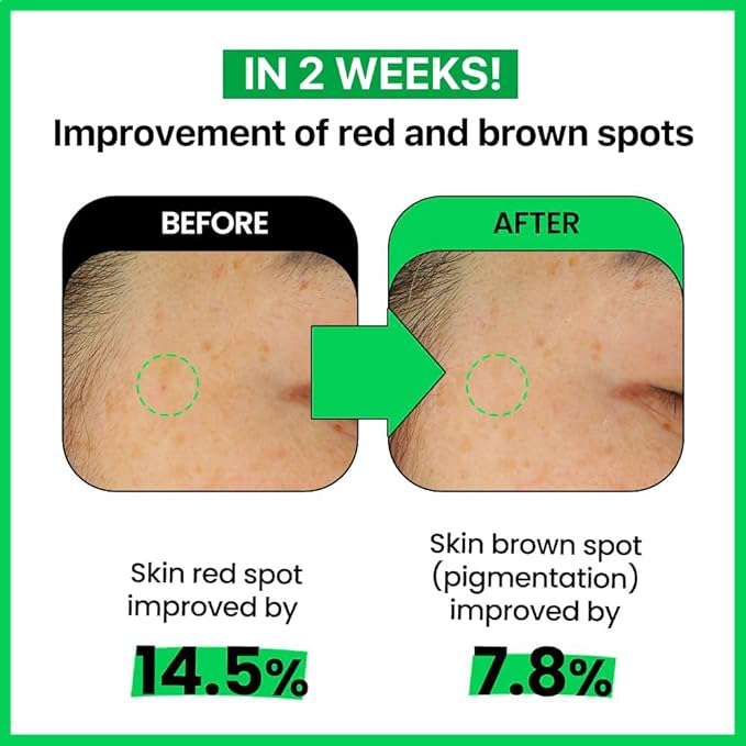 Real Barrier Cica Relief Rx Fade In Serum 50ml 1.69 fl. Oz. |Calming & Skin Recovery Face Serum, Instant Relief from Skin Irritation, Moisturizing & Soothing Serum for Sensitive Skin, Korean Skincare