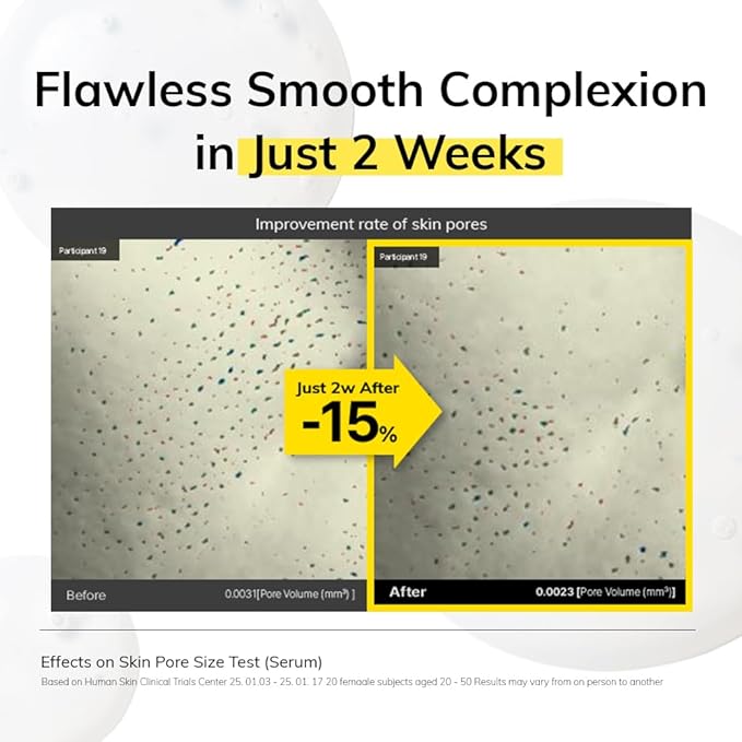 MIMUMIMU NIACINDY Lightweight Serum for Clarity Skin with Niacinamide 5% + Thioctic Acid, for Sensitive skin, Pore Smoothing, Korean Glass Skin, Glow Booster, Fragrance-Free (30ml/1.01 fl.oz)