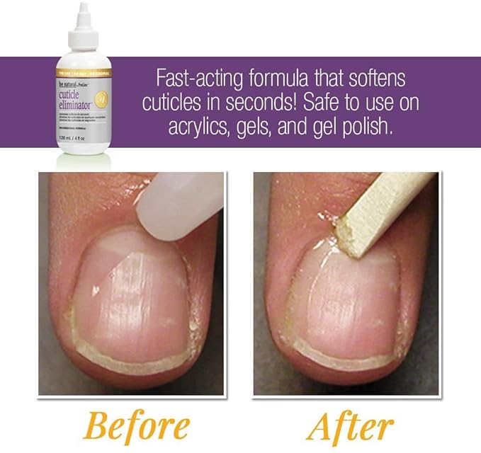 ProLinc Cuticle Eliminator, Softens and Removes Cuticles in Seconds, 4 oz