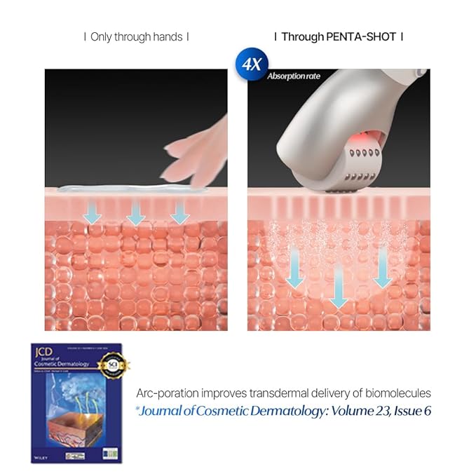 Potension Penta-Shot - Korean Skin Care Device, 5-in-1 Total Care Device for Enhanced Absorption, Intensive Pore Care, Needle Free, Professional Skincare Comfortably at Home