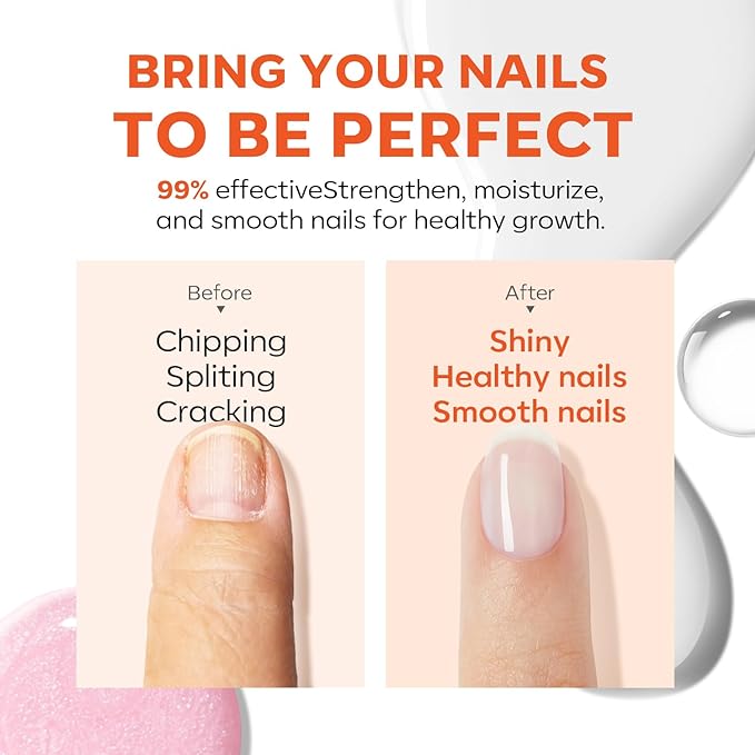 modelones Nail Strengthener Ridge Filler for Nails White Nail Polish Nail Repair for Thin and Damaged Nails Growth Treatment 15ml