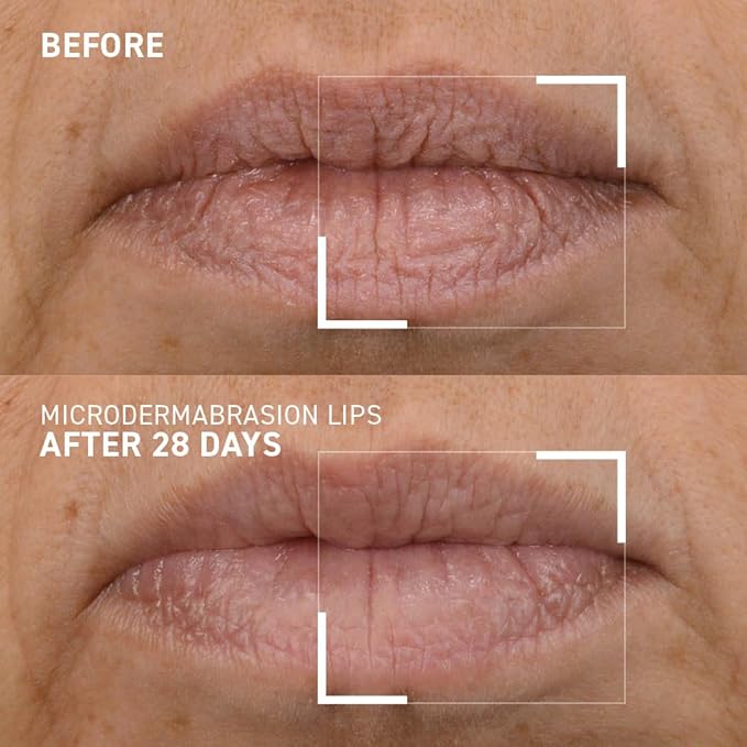 Dr. Brandt Microdermabrasion Smoothing Lip Scrub oz