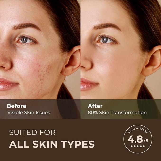 Gya Labs Australian Tea Tree Essential Oil for Skin - 0.34 Fl Oz - 100% Pure Natural Melaleuca Tea Tree Oil for Hair, Face, & Toenail, Piercings Scalp & Candle Making Scent