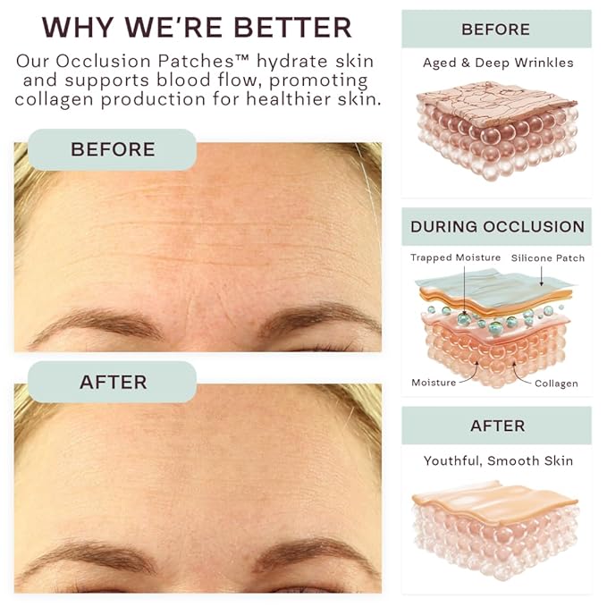 Dermaclara Face Patches Kit - Anti Wrinkle Patches for Forehead, Smile Lines, Silicone Anti-Wrinkle Frown Line Treatment, Up to 30 Uses - Kit: 1 Forehead, 2 Mouth, 2 Eye Patch & 1 Patch Prep Cleanser