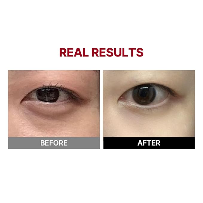 MEDITHERAPY Wrinkle-fit Tangle Eye Cream(Refill), Protein Collagen Eye Cream for Pufiness, Under-eye Bags, Dark Circles, Under Eye Treatment, 0.67 fl oz