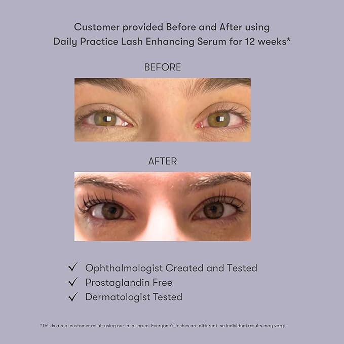 by Dr. B Lash Enhancing Serum – Peptides, Biotin, Niacinamide & Hyaluronic Acid – Paraben-Free, Phthalate-Free, Hydrating Formula, 4ml