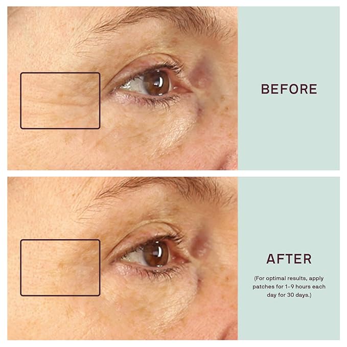 Dermaclara Eye & Mouth Patches - Anti-Wrinkle Silicone Patches for Smile Lines & Under Eye, Overnight Face Pads for Women & Men for Laugh & Frown Lines, Anti Aging, Reusable up to 30 Times - 4 Patches