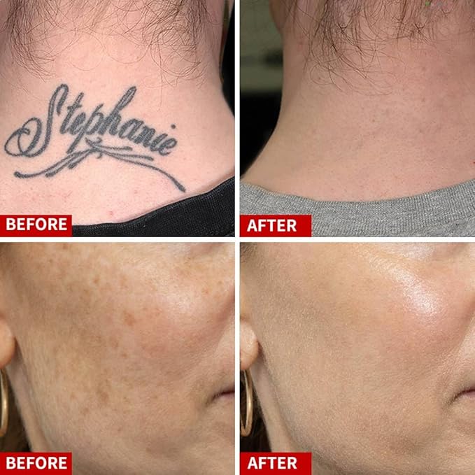 Red Pen Rechargeable for Face Skin Care