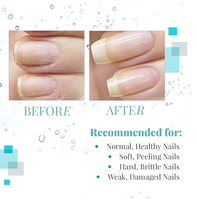 Nail Tek Renew Cuticle Oil for Nails – Natural Cuticle Oil with Tea Tree Oil, Nourishes & Moisturizes Dry Cuticles, 0.48 oz, 2-Pack