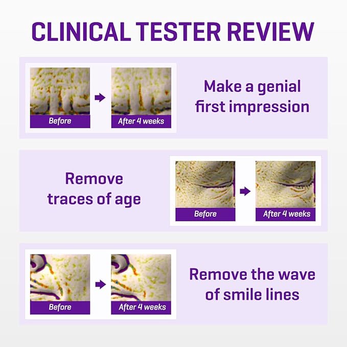 SOME BY MI Retinol Intense Advanced Triple Action Eye Cream + Retinol Intense Daily Mask