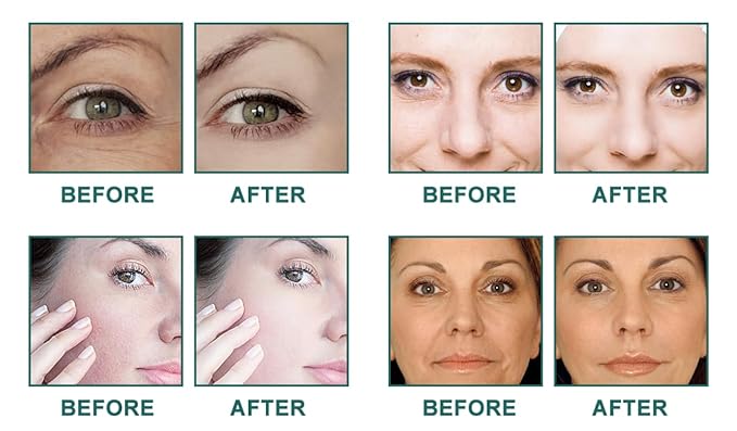 Retinol Cream for Face, Face Moisturizer with Retinol, Day and Night Cream, Wrinkle Repair, Anti-Aging Moisturizing Cream for Women and Men, for All Skin Types, 50 ml / 1.69 Oz