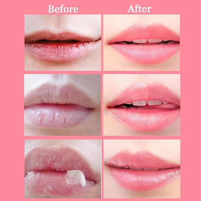 2 Pcs Lip Balm Honey Pot,Honey Wrinkle