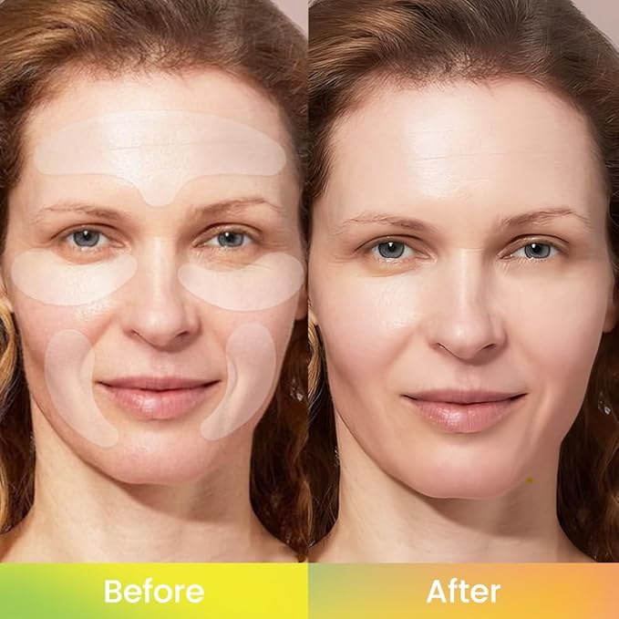 evpct 5Pcs Reusable Silicone Face Tape Wrinkle Patches for Forehead Under Eye and Smile Fine Lines, Face Tape for Castor Oil, Facial Tape Smoothing Forehead Wrinkle Patches for Face Wrinkles Overnight