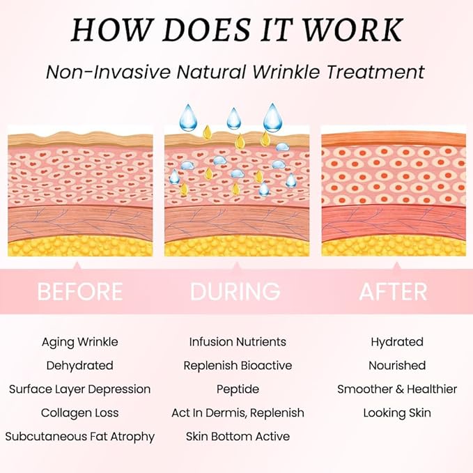 evpct 1Pcs Silicone Chest Smoothing Wrinkle Pads Reusable, Silicone Anti Chest Wrinkle Patches Reusable for Chest Wrinkles Overnight, Décolleté Chest Wrinkle Pillow Pads for Smoother,Size M-Love Heart