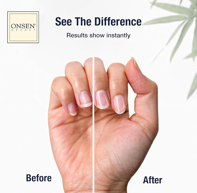 Onsen Nail & Cuticle Cream Treatment w/Japanese Tsubaki, Jojoba & Lavender Oil, Shea Butter – Strengthens Nails, Softens Cuticles - Daily Repair Care (2 Count/15 ml)