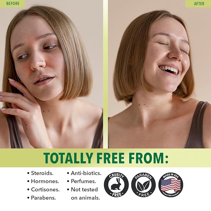 Dr. Robaina 100% Pure Moringa Oil – Deep Hydration, Skin Repair & Natural Antioxidants – Cold-Pressed, Organic & All-Natural Moisturizer – Made in USA