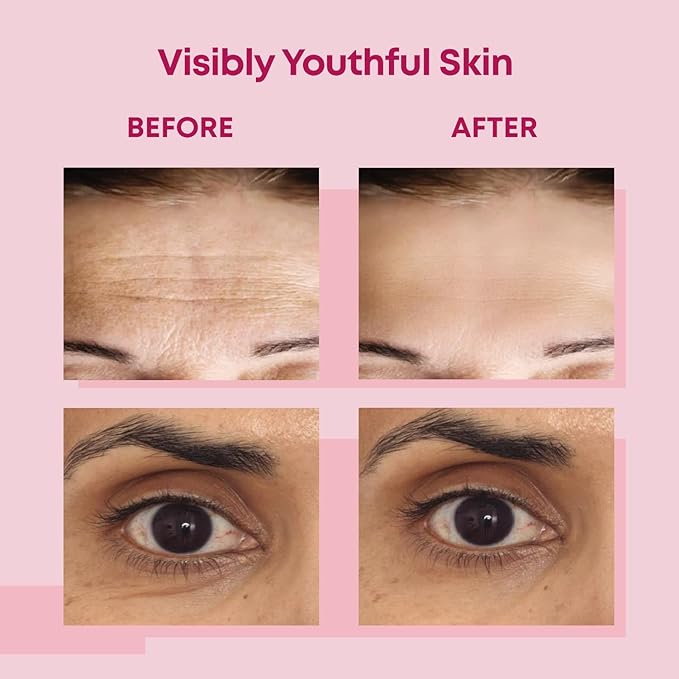 Bayside Forehead & Under Eye Wrinkle Patches Set | Hyaluronic Acid, Collagen & Vitamin E | Overnight Smoothing Treatment for Fine Lines & Wrinkles | Non-Invasive, Skin-Friendly Hydrating Care