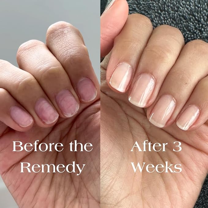 Botanist The Remedy | Nail Strengthening Polish | Repairs & Hardens Nails Damaged from Acrylics, Dip & Gel Manicures | Non-Toxic, 77% Plant Based, 21-Free & Vegan (Nude)