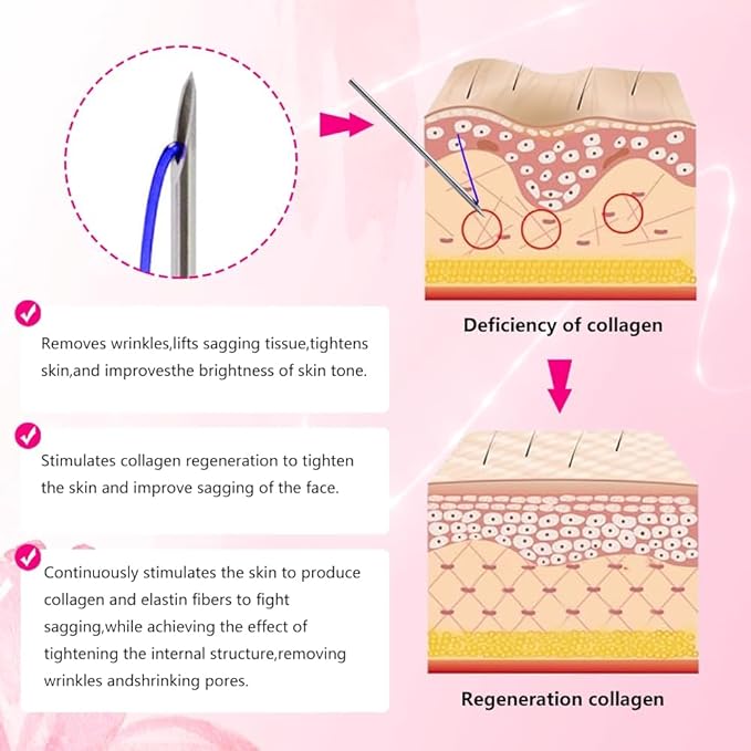 PDO Thread For Face Lift/Whole Body Lift Mono Thread Sharp (Mono 30G 13mm 20pcs)