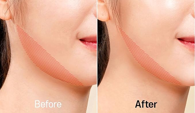 [ABSOLUTE Natural-LIFTING] Wrinkle Corrector Bakuchiol Volufiline Spicule 3000 Shot NIGHT Cream (30ml), for HIGH-END Care