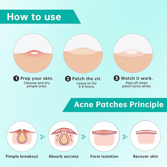 Pimple Patches for Face， Acne Patches/Hydrocolloid Patches for Covering Zits and Blemishes/Spot Care for Face，Absorb Fluid,4 size (210 Count)