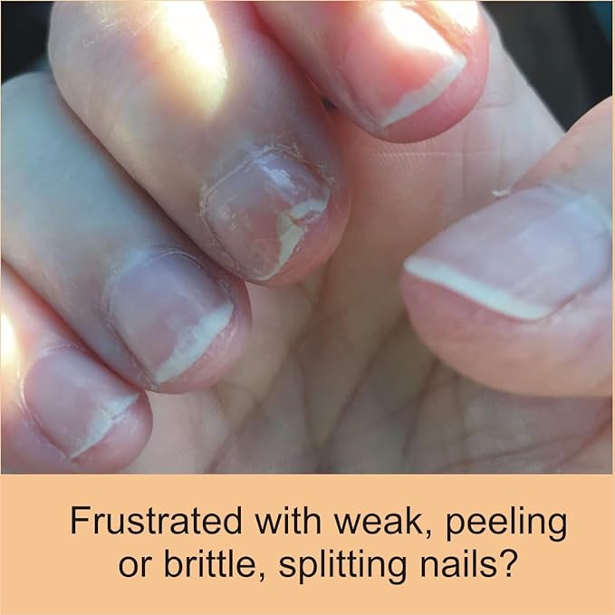 Penetrating Fingernail Conditioner and Strengthener to repair and then maintain weak and peeling or brittle and splitting nails - Single Bottle