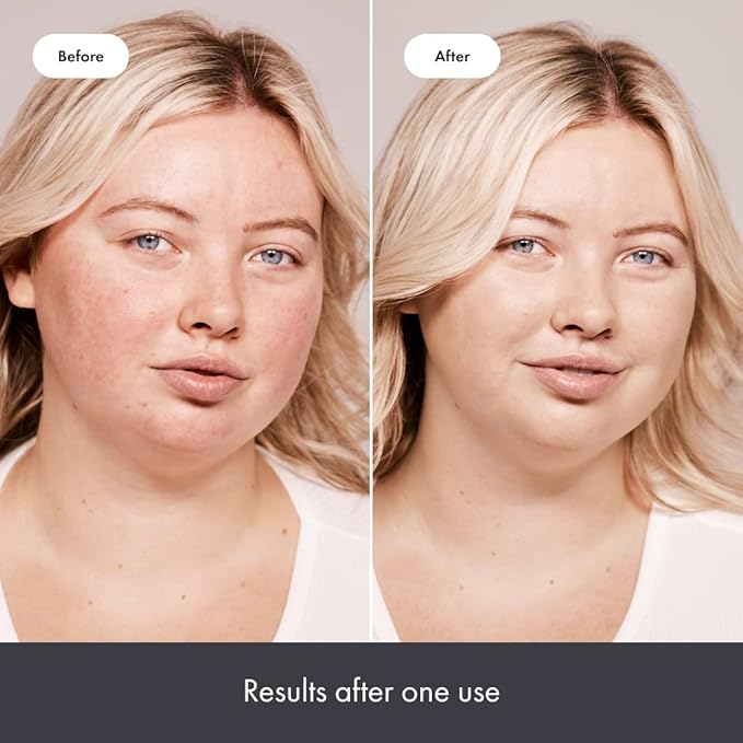 Hero Cosmetics Rescue Balm + Red Correct: Post-Blemish Recovery Cream, Nourishing & Calming, Dermatologist Tested, Vegan (1.69 fl oz)