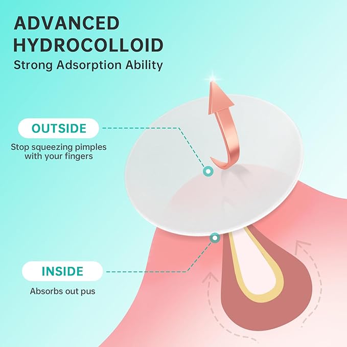 Pimple Patches for Face， Acne Patches/Hydrocolloid Patches for Covering Zits and Blemishes/Spot Care for Face，Absorb Fluid,4 size (210 Count)