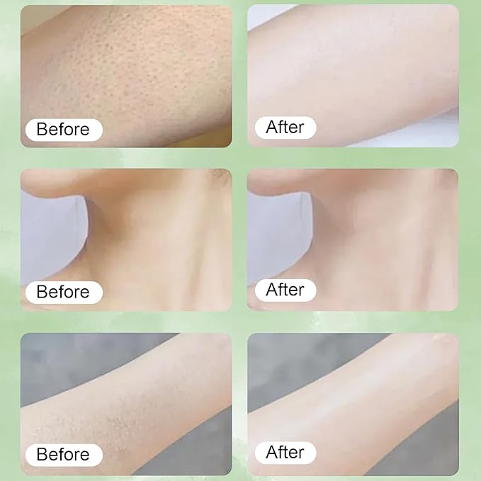 Neuropathy Cream, Magnesium Cream for Neuropathy,Magnesium Body Butter,Long-Lasting Hydration to Keep Skin Feeling Soft,Suitable for All Skin Types(6pcs)