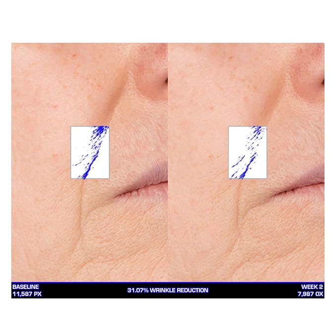 Serious Skincare Ultra-Mare Pure Marine Infusion Facial Serum - Encourages Collagen Production, Cell Turnover and Plumper Skin - Niacinamide - Acid Free - Concentrated 2 oz.