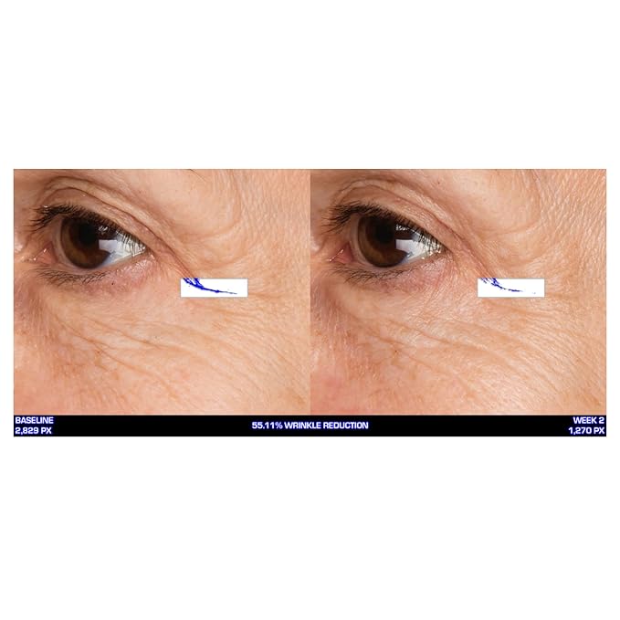 Serious Skincare Ultra-Mare Pure Marine Infusion Facial Serum - Encourages Collagen Production, Cell Turnover and Plumper Skin - Niacinamide - Acid Free - Concentrated 2 oz.