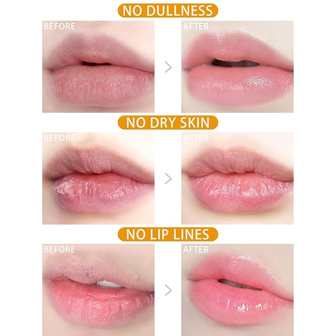 4PCS Bee Lip Balm Honey Pot,