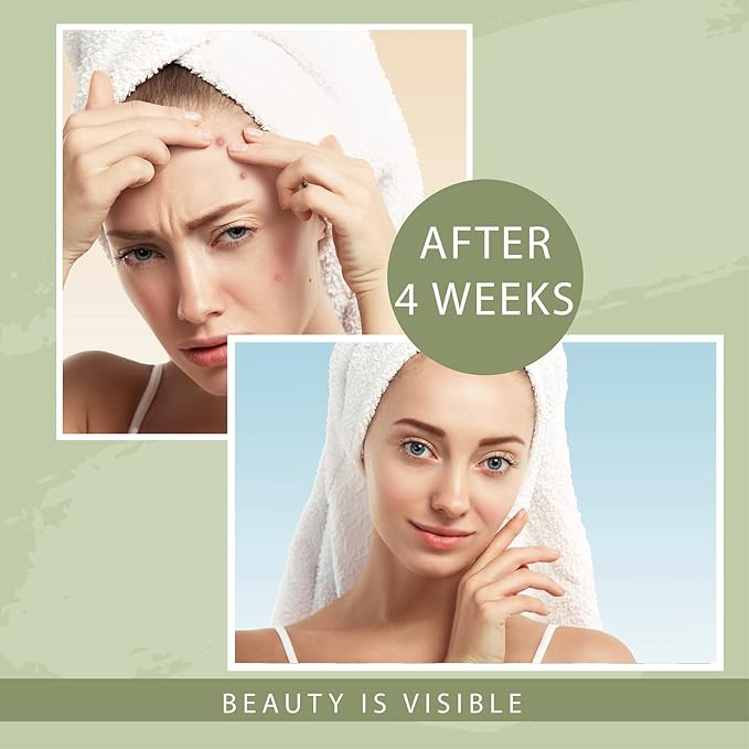 OSITO LED Face Mask Light Therapy, FSA/HSA Eligible, Red and Blue Light Therapy for Face, 4-in-1 Color LED Face Mask for Facial Wrinkle and Acne Reduction