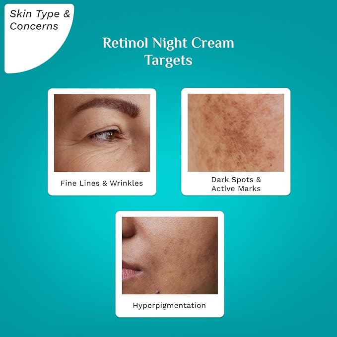 Korean Retinol Anti Aging Night Cream with Hyaluronic Acid & Vitamin C | wrinkle-free & radiant skin| Anti aging cream for oily & dry skin| For Men & Women|Korean Skin Care| 1.76 Oz (50gm)