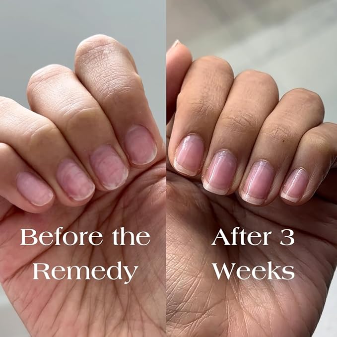 Botanist The Remedy | Nail Strengthening Polish | Repairs & Hardens Nails Damaged from Acrylics, Dip & Gel Manicures | Non-Toxic, 84% Plant Based, 21-Free & Vegan (Rose)