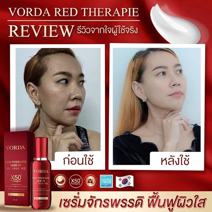 Vorda Red Therapie Serum Facial 30ml Made In Korea X50 Photoglow